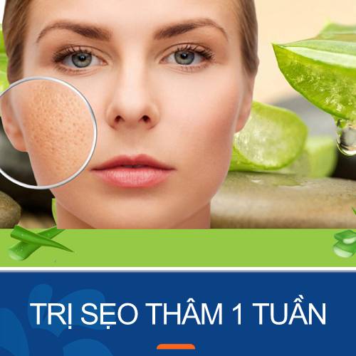 9 Cách trị sẹo thâm 1 tuần tại nhà hiệu quả nhanh chóng