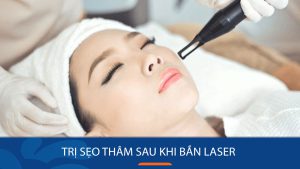 Cách trị sẹo thâm sau khi bắn laser hiệu quả và nhanh chóng