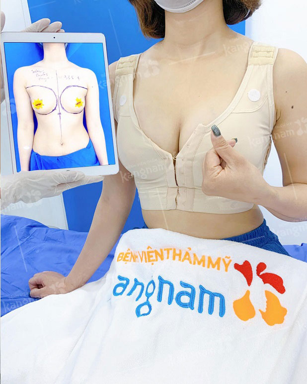 Khách hàng tại Kangnam chọn size ngực phù hợp
