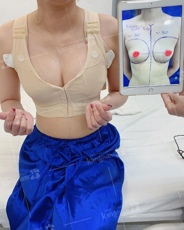Ngực đẹp tự nhiên khi lựa chọn size ngực phù hợp