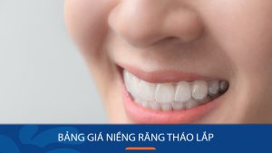 Bảng giá niềng răng tháo lắp mới nhất – Bệnh viện thẩm mỹ Kangnam