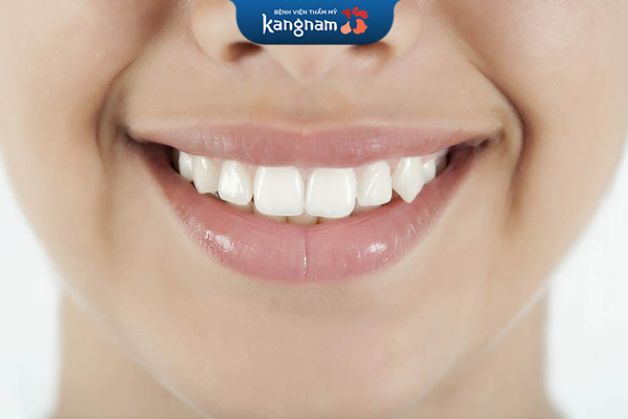 Răng khểnh tự nhiên là răng nanh số 3 bị mọc lệch trên nướu