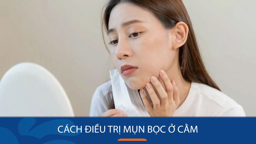 Cách trị mụn bọc ở cằm hiệu quả và an toàn