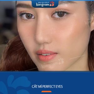 Cắt mí Perfect Eyes – Công nghệ tốt nhất, tạo mắt 2 mí đẹp chuẩn tỉ lệ