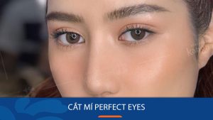 Cắt mí Perfect Eyes – Công nghệ tốt nhất, tạo mắt 2 mí đẹp
