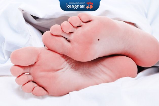 Nốt ruồi nằm tại lòng bàn chân cho thấy bạn sẽ có nhiều cơ hội ra nước ngoài sinh sống