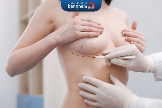 Nâng ngực qua đường nào tốt nhất?