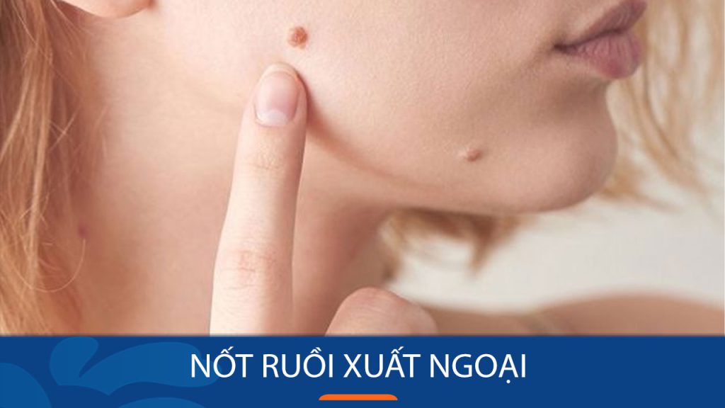 Hé lộ 10 vị trí nốt ruồi ‘đắc địa’ mang lại tài lộc khi xuất ngoại