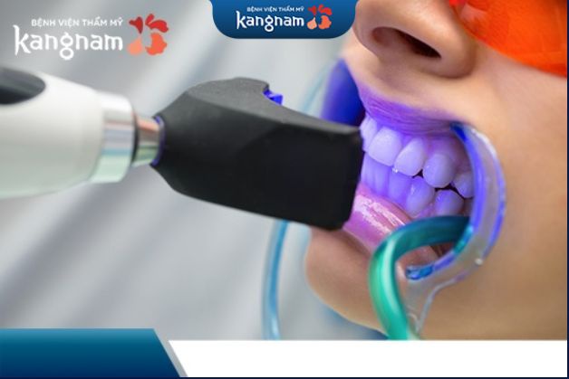 Thăm khám và chụp X-quang răng bởi bác sĩ nha khoa Kangnam
