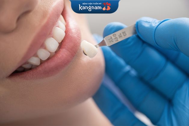 Răng cercon HT có độ bền cực cao