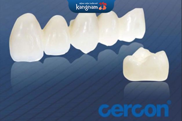 Răng sứ cercon có nhiều điểm ưu việt