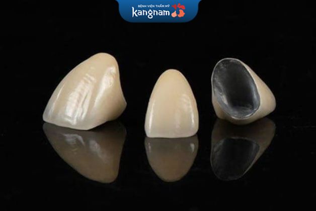Răng sứ bằng kim loại mang đến độ bền cao