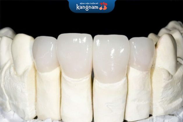 Răng sứ kim loại ngày càng được ứng dụng nhiều trong nha khoa