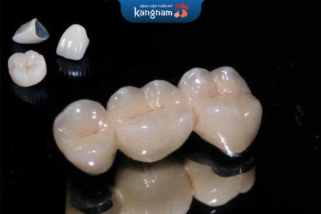 Cải thiện được những khuyết điểm như răng xỉn màu, răng sâu, răng hô, sứt mẻ