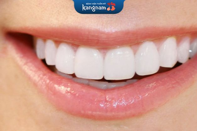 sứ thẩm mỹ là răng giả mang hình dáng và màu sắc tương tự răng thật