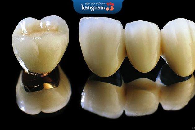 Răng sứ Titan là răng giả làm bằng sứ có cấu trúc lõi hợp kim bao phủ bằng lớp sứ