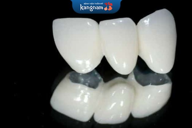 Titan Margin là thuật ngữ nói đến dòng răng kim loại bình thường