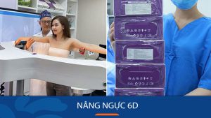 Nâng ngực 6D VIP giá bao nhiêu? Tham khảo bảng giá Kangnam