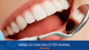 Răng sứ cercon có tốt không? Cách tăng tuổi thọ răng sứ