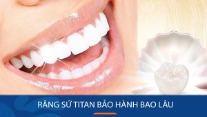 Răng sứ titan bảo hành bao lâu , Bí quyết chăm sóc răng