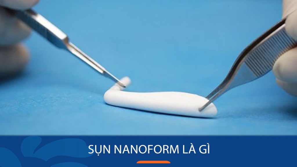 Sụn nanoform là gì? Giải mã bí ẩn sụn nâng mũi thế hệ mới