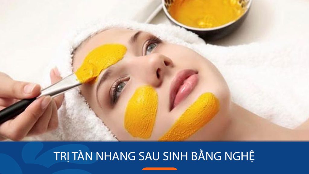 Mách bạn 10 cách trị tàn nhang sau sinh bằng nghệ hiệu quả