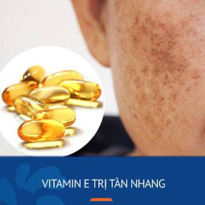 Vitamin e trị tàn nhang: 7 công thức xóa sạch đốm nâu, da sáng mịn