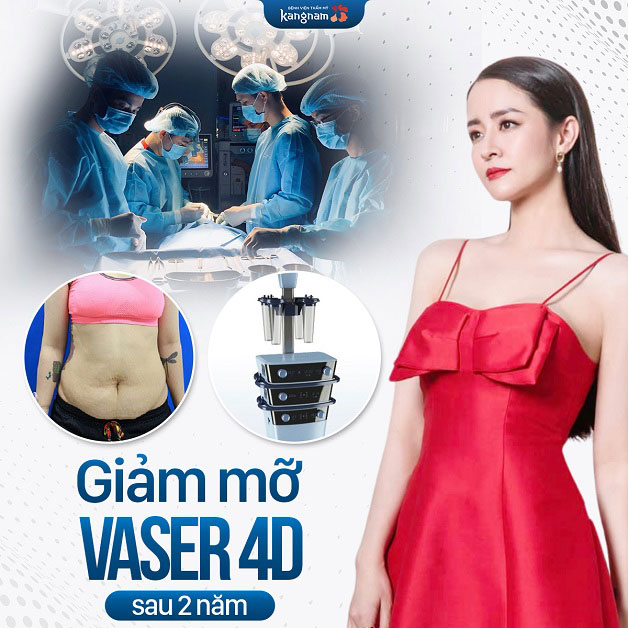 Hút mỡ Vaser 4D hiệu quả, an toàn tại Kangnam