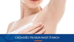 Cách điều trị mụn nhọt ở nách: Bí quyết loại bỏ mụn nhọt ở nách tận gốc