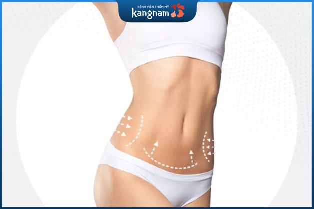 Phẫu thuật tái tạo thành bụng đem đến sắc vóc gọn gàng, eo thon dáng chuẩn