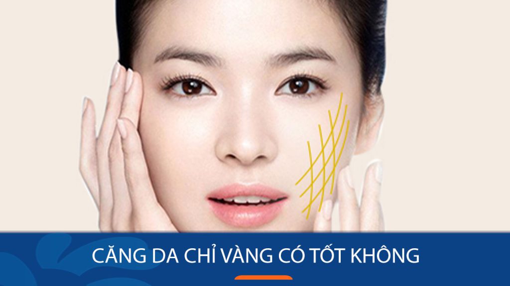Căng da chỉ vàng có tốt không: 9 lưu ý khi sử dụng