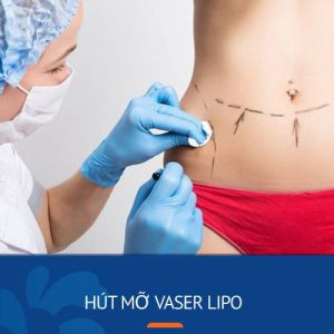 Hút mỡ Vaser Lipo – Vắt kiệt mỡ toàn thân, hạn chế xâm lấn