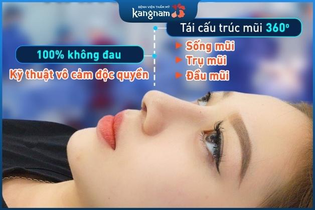 Nâng mũi 6D Surgiform hiệu quả thẩm mỹ cao tại Kangnam