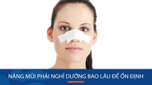 Tiểu phẫu: Sau nâng mũi nghỉ dưỡng bao lâu? Các giai đoạn phục hồi quan trọng