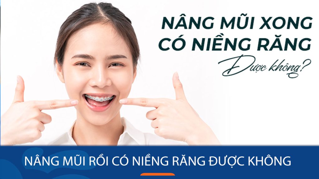 Nâng mũi rồi có niềng răng được không? Giải đáp từ chuyên gia nha khoa