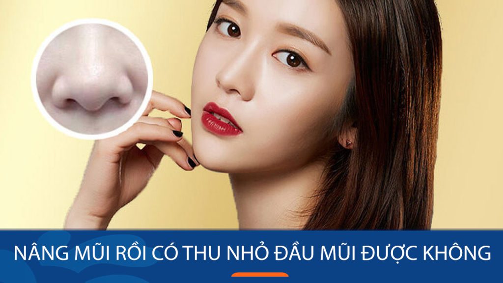 Nâng mũi rồi có thu nhỏ đầu mũi được không? Kangnam giải đáp
