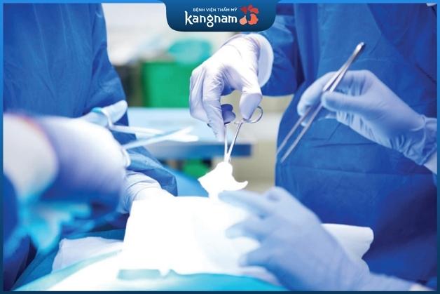 Phẫu thuật tại Kangnam được thực hiện khép kín với quy trình chuẩn