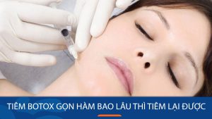 Tiêm botox gọn hàm: Bao lâu thì tiêm lại để duy trì hiệu quả lâu dài?