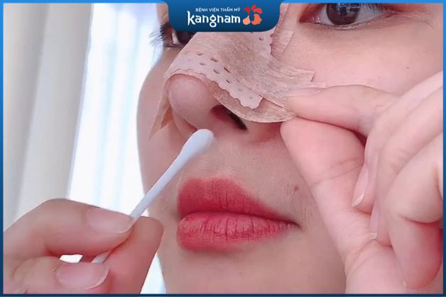Cách chăm sóc sau khi nâng mũi 6D Nanoform từ bác sĩ phẫu thuật Kangnam