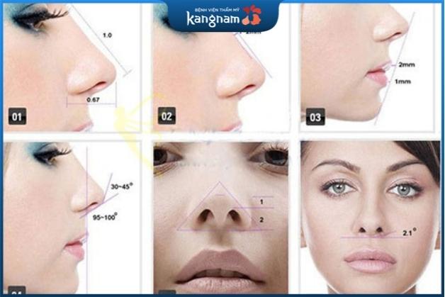 sửa mũi hỏng sau nâng 2