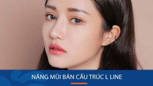 Nâng mũi bán cấu trúc L Line là gì? Bí quyết sở hữu dáng mũi L Line