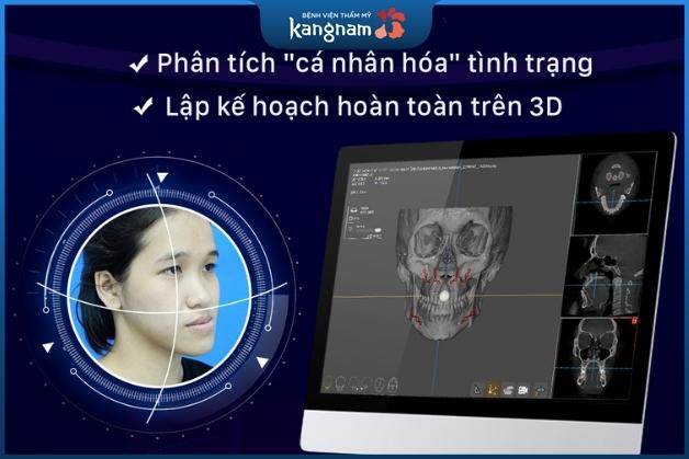 Sử dụng công nghệ Vectra 3D để thiết kế gương mặt