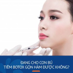Đang cho con bú tiêm botox gọn hàm được không? Kangnam giải đáp