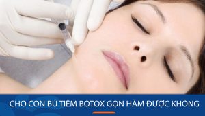 Đang cho con bú tiêm botox gọn hàm được không?bác sĩ kangnam giải đáp