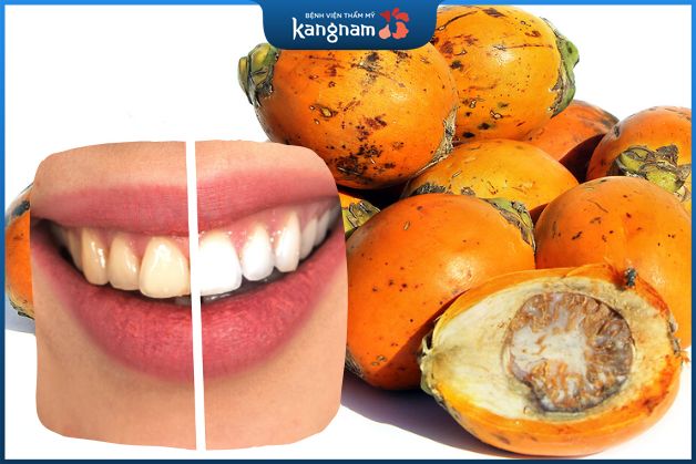 Răng trắng đều khi sử dụng trái cau