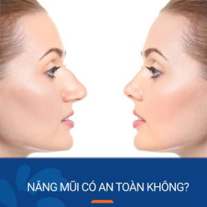 Nâng mũi có an toàn không? Nâng mũi tại Kangnam đẹp toàn diện