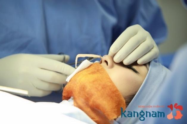  Bác sĩ Kangnam thực hiện tiêm chất làm đầy nâng mũi cao cho khách hàng