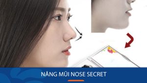 Dụng cụ nâng mũi NOSE SECRET cao thon chỉ trong 15 phút mỗi ngày