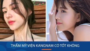 Nâng mũi ở BV Kangnam có tốt không – Review từ khách hàng