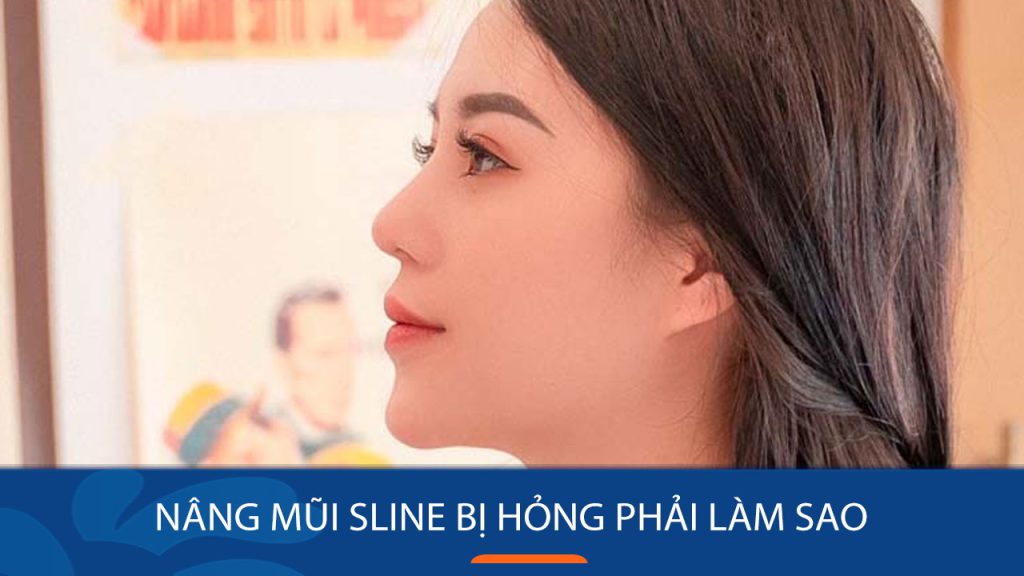 Nâng mũi sline bị hỏng phải làm sao – BV Kangnam trả lời